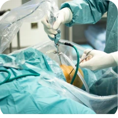 Cirurgia de Menisco