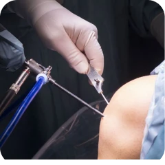 Reconstrução Ligamentar